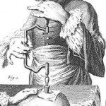 220px-Trepanation_illustration_France_1800s